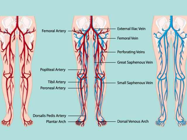 Angiologia – Chirurgia Vascolare
